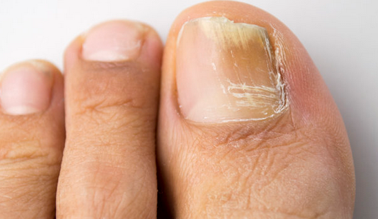 ����ָ��С�r(sh��)���а񡿻�ָ����ʲôӰ푣���Ҋ������������Щ��